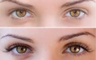 Before and After Lilash Pics